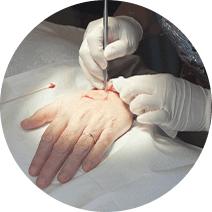SKIN CANCER & MOHS SURGERY