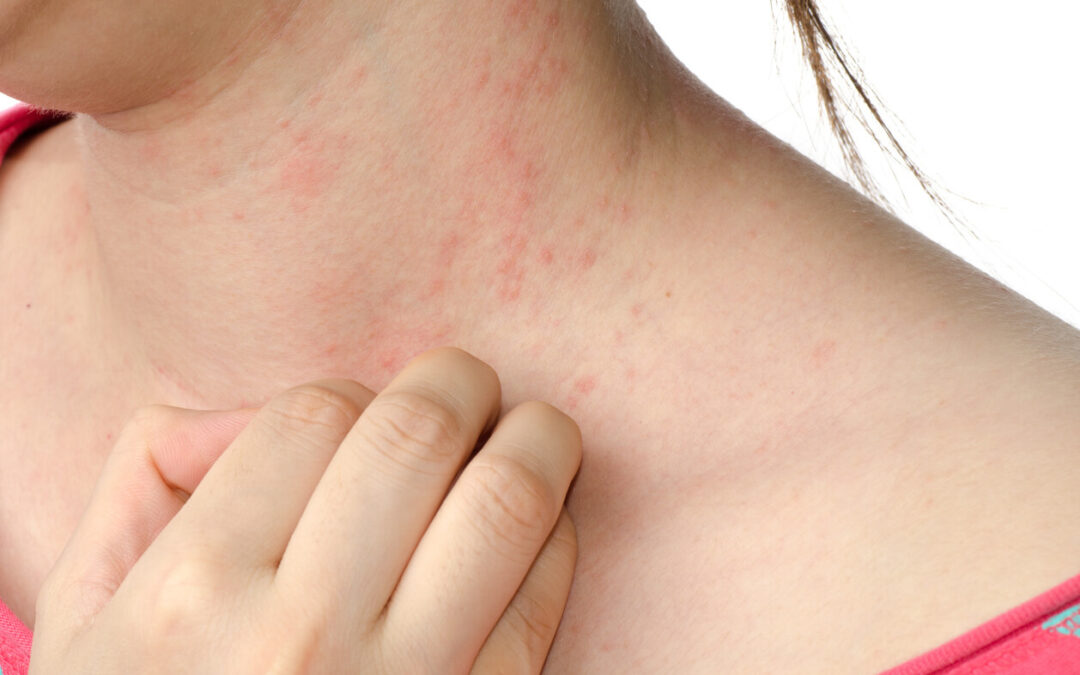 Signs You Need to See a Dermatologist