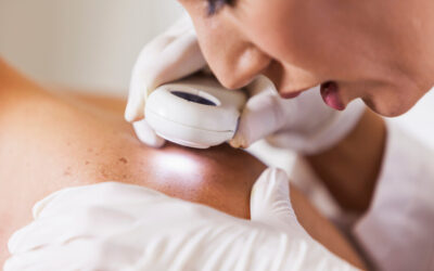 Visiting a Skin Cancer Specialist? What to Expect