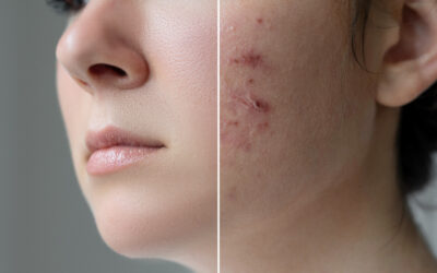 How Can a Dermatologist Help You?