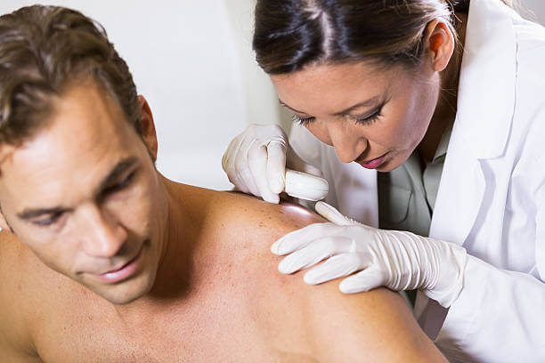 Everything You Need to Know About Skin Cancer Screening